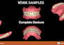 design any dental restorations you need using exocad
